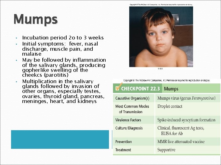 Mumps • • Incubation period 2 o to 3 weeks Initial symptoms: fever, nasal