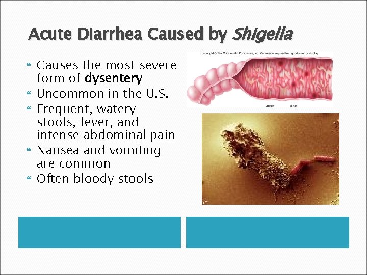 Acute Diarrhea Caused by Shigella Causes the most severe form of dysentery Uncommon in