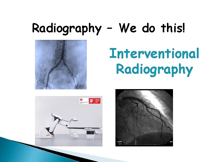 Radiography – We do this! Interventional Radiography 