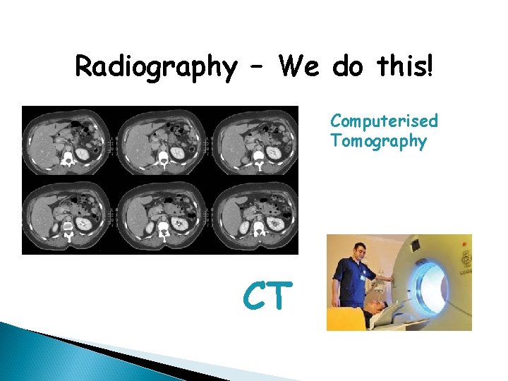 Radiography – We do this! Computerised Tomography CT 