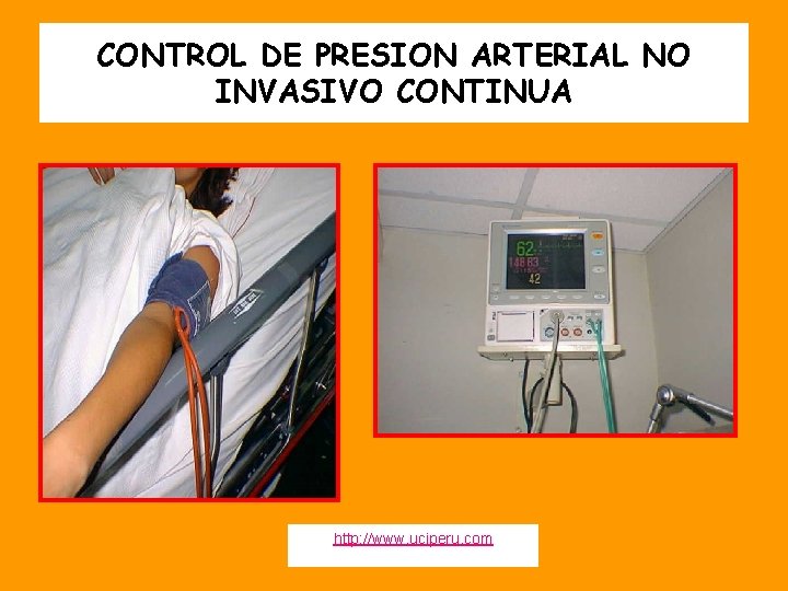 CONTROL DE PRESION ARTERIAL NO INVASIVO CONTINUA http: //www. uciperu. com 