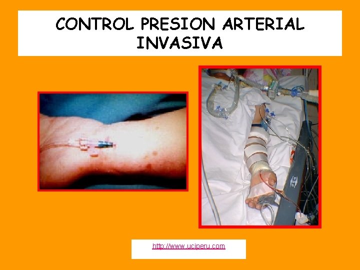 CONTROL PRESION ARTERIAL INVASIVA http: //www. uciperu. com 