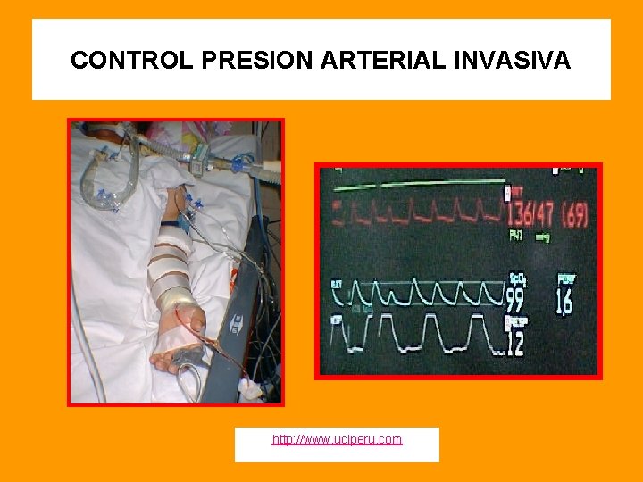 CONTROL PRESION ARTERIAL INVASIVA http: //www. uciperu. com 