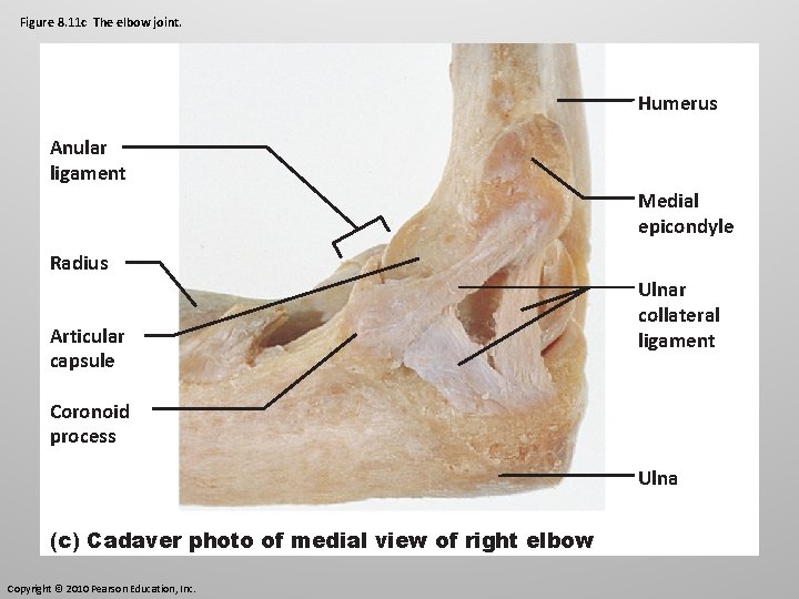 Figure 8. 11 c The elbow joint. Humerus Anular ligament Medial epicondyle Radius Articular