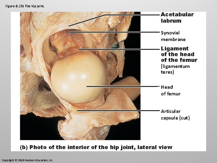 Figure 8. 12 b The hip joint. Acetabular labrum Synovial membrane Ligament of the