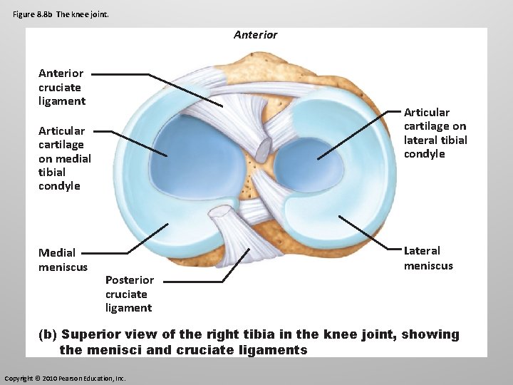 Figure 8. 8 b The knee joint. Anterior cruciate ligament Articular cartilage on lateral