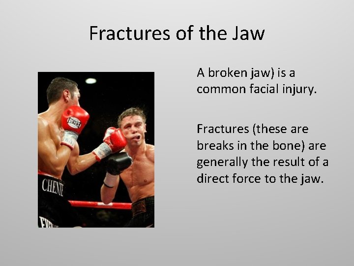 Fractures of the Jaw A broken jaw) is a common facial injury. Fractures (these