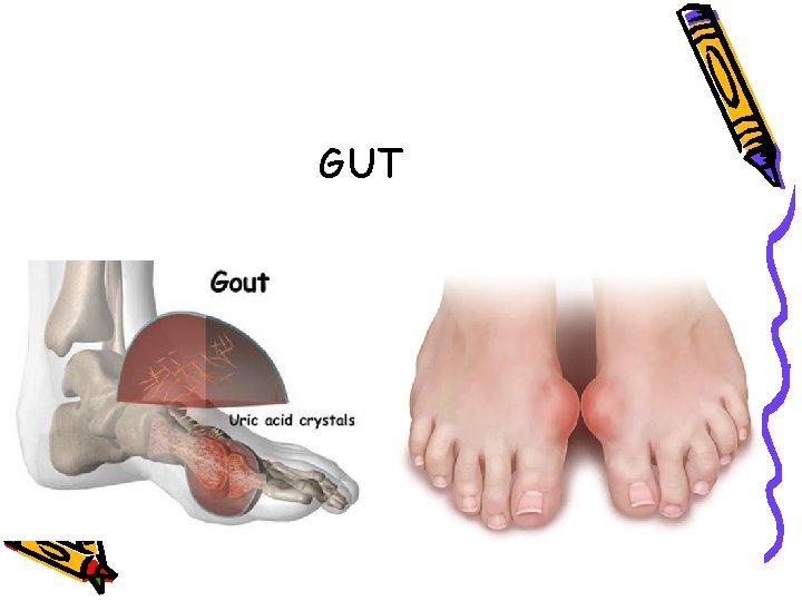 GUT GUT