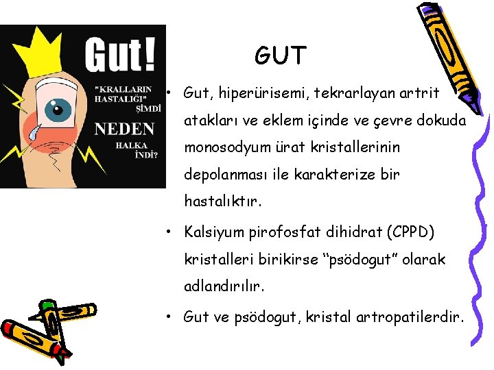 GUT • Gut, hiperürisemi, tekrarlayan artrit atakları ve eklem içinde ve çevre dokuda monosodyum GUT • Gut, hiperürisemi, tekrarlayan artrit atakları ve eklem içinde ve çevre dokuda monosodyum