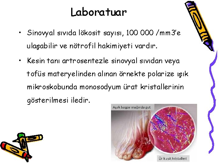 Laboratuar • Sinovyal sıvıda lökosit sayısı, 100 000 /mm 3’e ulaşabilir ve nötrofil hakimiyeti Laboratuar • Sinovyal sıvıda lökosit sayısı, 100 000 /mm 3’e ulaşabilir ve nötrofil hakimiyeti