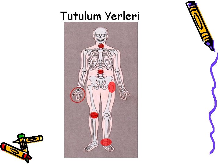 Tutulum Yerleri Tutulum Yerleri
