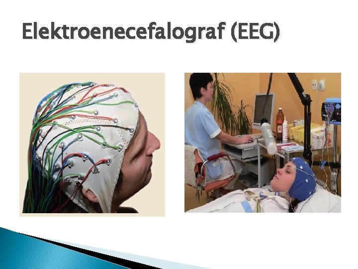 Elektroenecefalograf (EEG) 