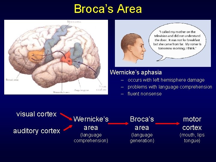 Broca’s Area Wernicke’s aphasia – occurs with left hemisphere damage – problems with language Broca’s Area Wernicke’s aphasia – occurs with left hemisphere damage – problems with language
