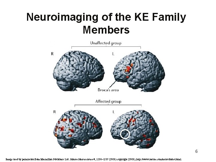 Neuroimaging of the KE Family Members 6 Image used by permission from Macmillan Publishers