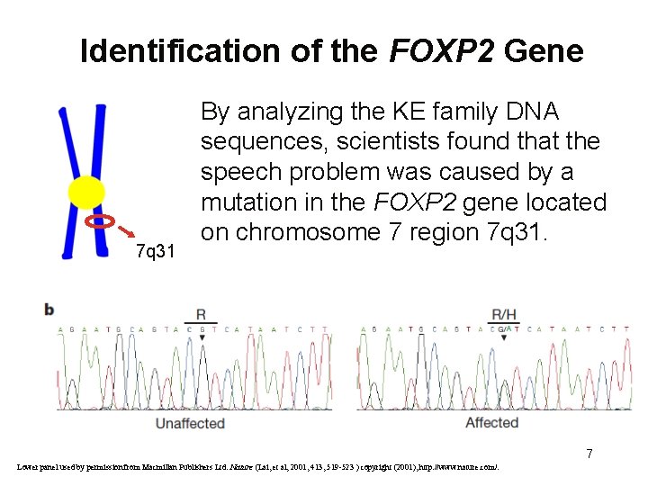 Identification of the FOXP 2 Gene 7 q 31 By analyzing the KE family