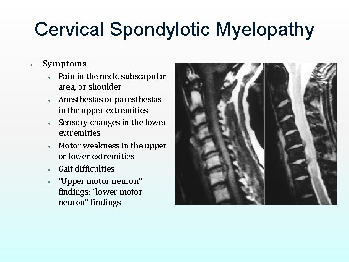 Cervical Spondylotic Myelopathy Symptoms ³ ³ ³ Pain in the neck, subscapular area, or