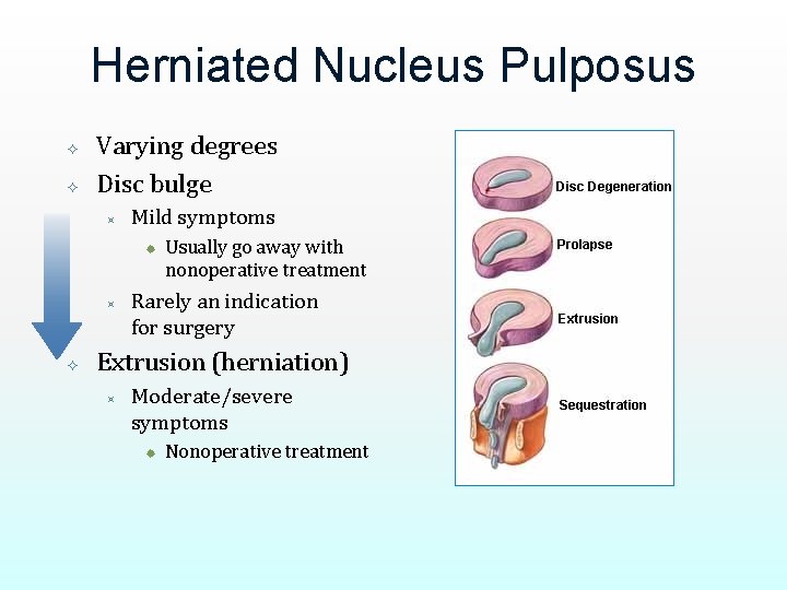 Herniated Nucleus Pulposus Varying degrees Disc bulge ³ Mild symptoms ® ³ Usually go