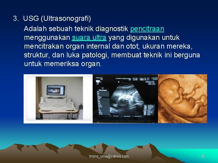 3. USG (Ultrasonografi) Adalah sebuah teknik diagnostik pencitraan menggunakan suara ultra yang digunakan untuk