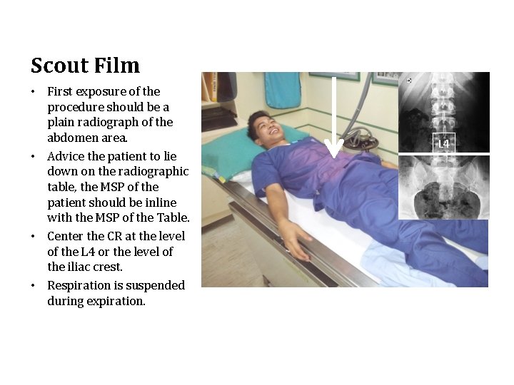 Scout Film • First exposure of the procedure should be a plain radiograph of
