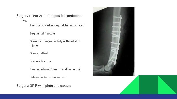Surgery is indicated for specific conditions like: Failure to get acceptable reduction. • •