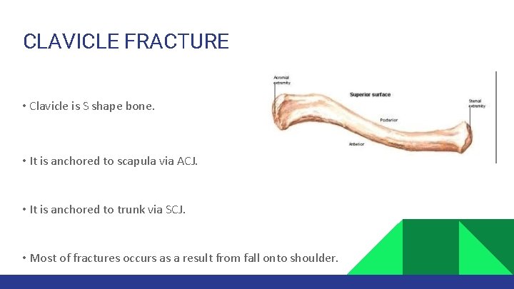 CLAVICLE FRACTURE •  Clavicle is S shape bone. •  It is anchored to scapula