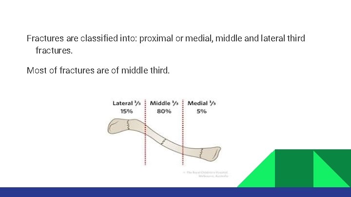 Fractures are classified into: proximal or medial, middle and lateral third fractures. Most of