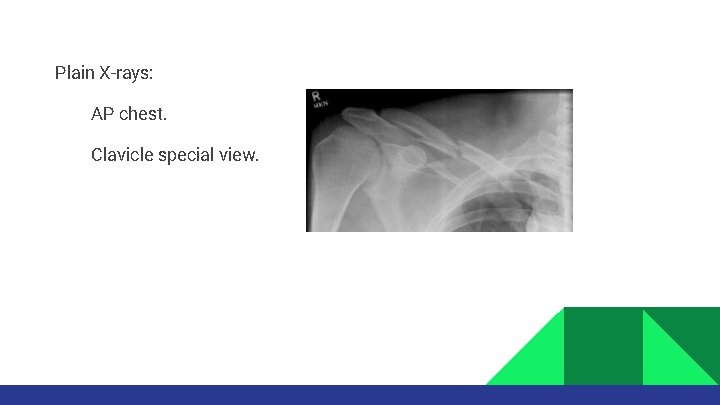 Plain X-rays: AP chest. Clavicle special view. 