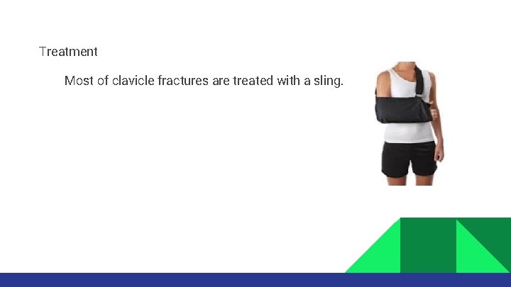 Treatment Most of clavicle fractures are treated with a sling. 