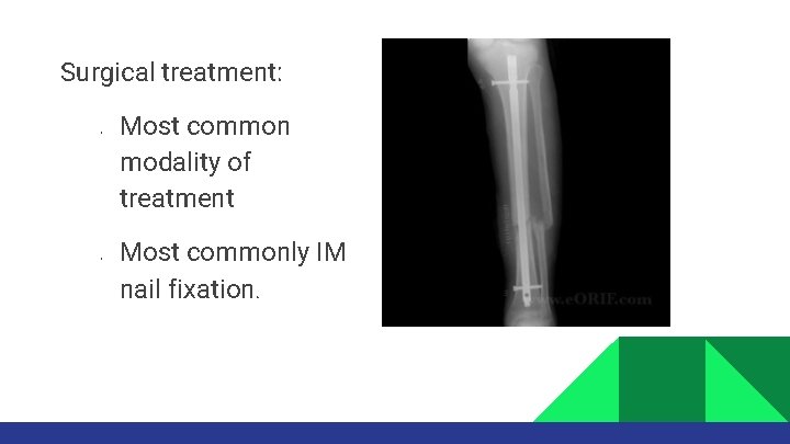 Surgical treatment: • • Most common modality of treatment Most commonly IM nail fixation.