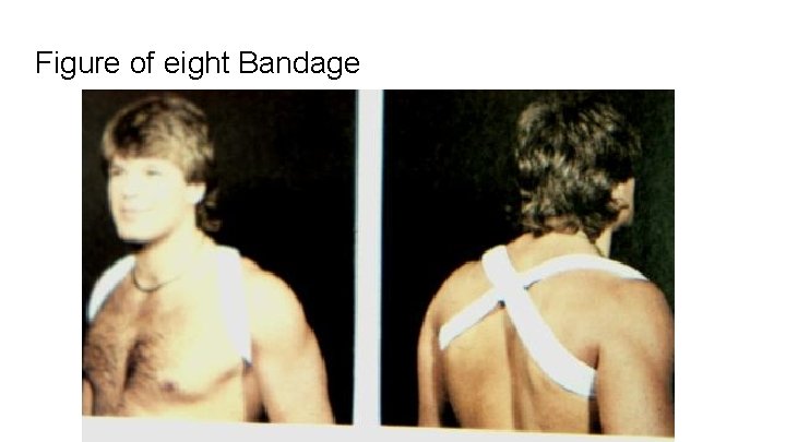 Figure of eight Bandage 