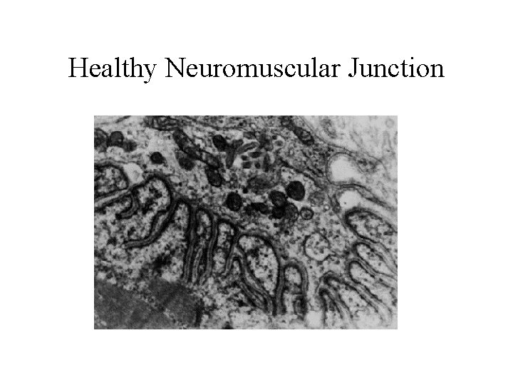 Healthy Neuromuscular Junction 