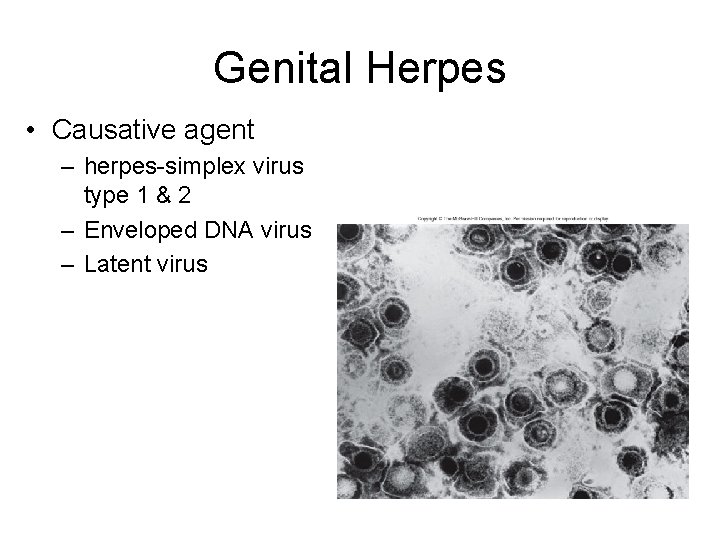 Genital Herpes • Causative agent – herpes-simplex virus type 1 & 2 – Enveloped