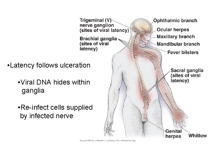  • Latency follows ulceration • Viral DNA hides within ganglia • Re-infect cells