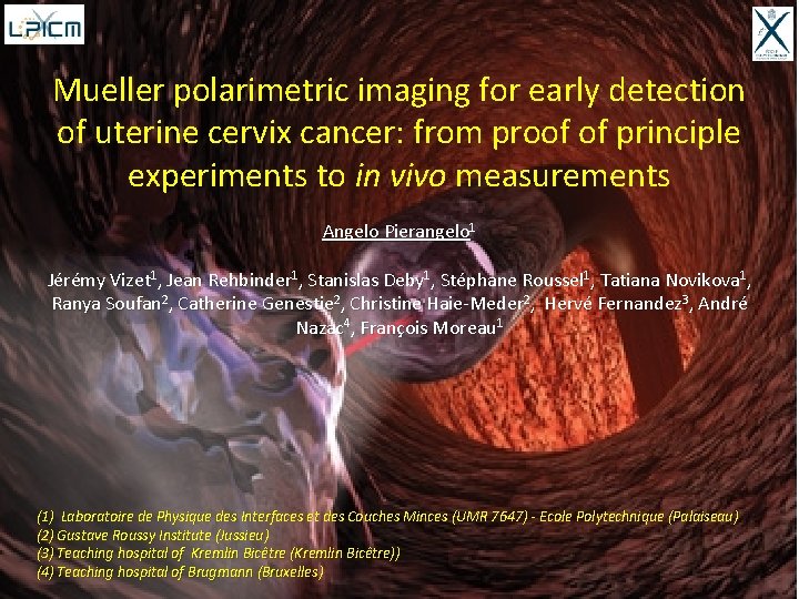 Mueller polarimetric imaging for early detection of uterine cervix cancer: from proof of principle