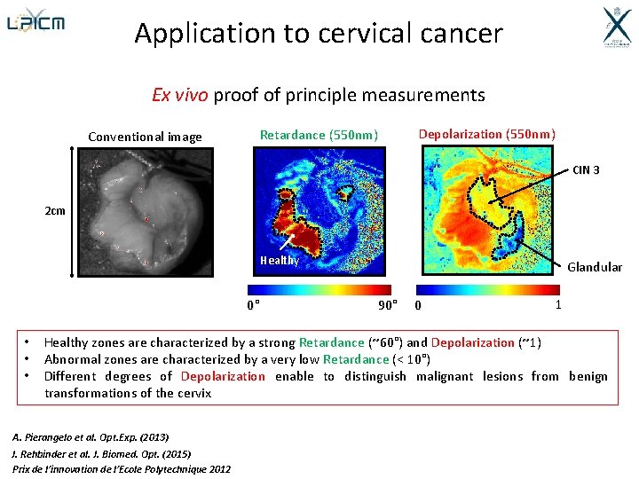 Application to cervical cancer Ex vivo proof of principle measurements Retardance (550 nm) Conventional