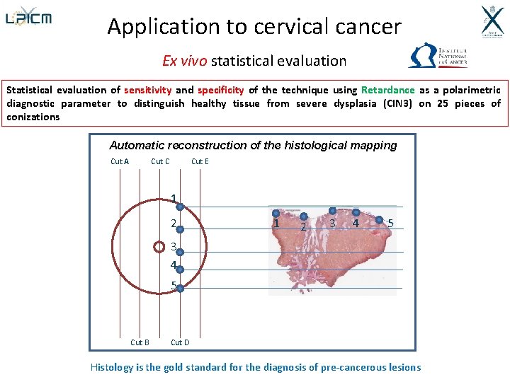 Application to cervical cancer Ex vivo statistical evaluation Statistical evaluation of sensitivity and specificity