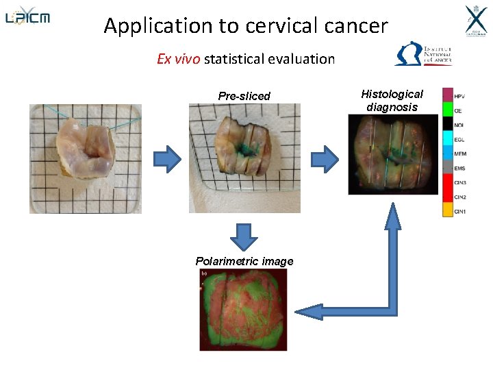 Application to cervical cancer Ex vivo statistical evaluation Pre-sliced Polarimetric image Histological diagnosis 