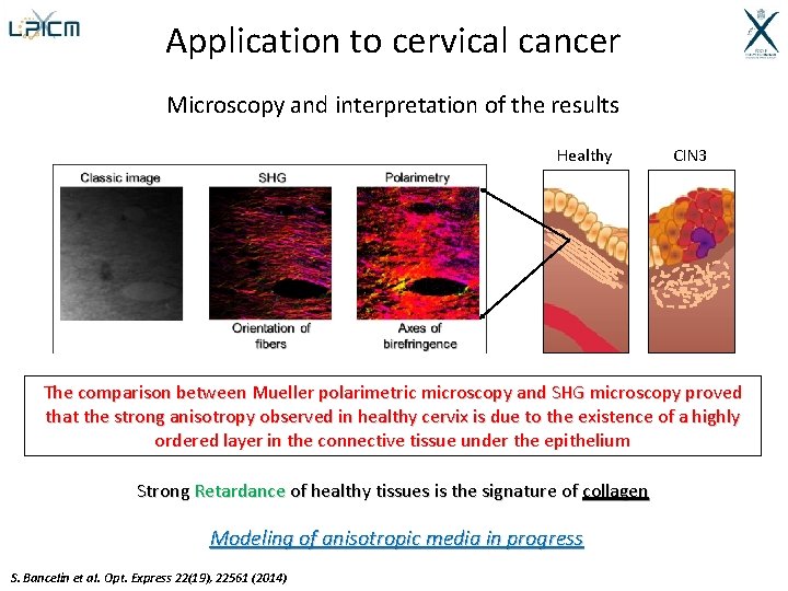 Application to cervical cancer Microscopy and interpretation of the results Healthy CIN 3 The