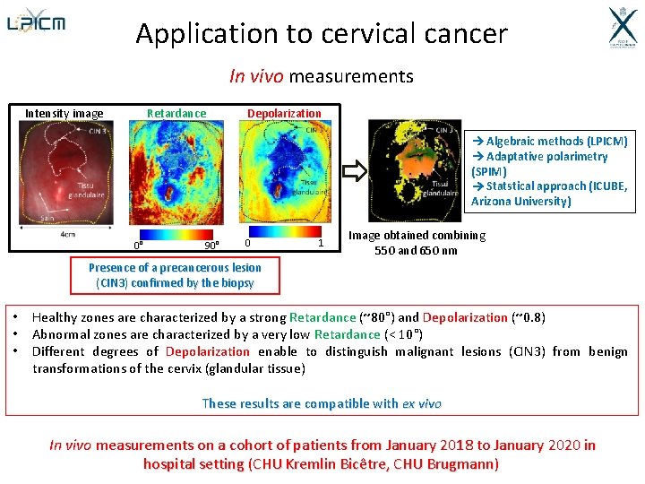 Application to cervical cancer In vivo measurements Intensity image Retardance Depolarization Algebraic methods (LPICM)