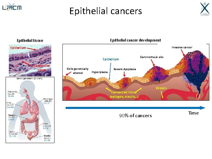 Epithelial cancers Epithelial cancer development Epithelial tissue Invasive cancer Epithelium Carcinoma in situ Epithelium