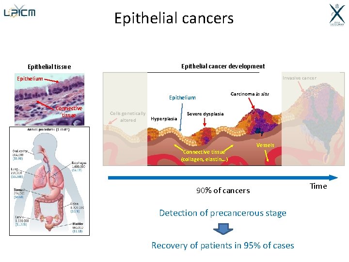 Epithelial cancers Epithelial cancer development Epithelial tissue Invasive cancer Epithelium Carcinoma in situ Epithelium