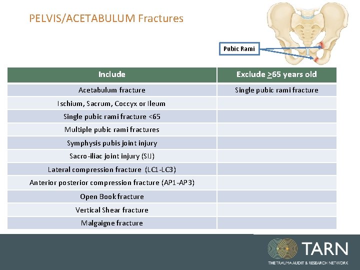 PELVIS/ACETABULUM Fractures Pubic Rami Include Exclude >65 years old Acetabulum fracture Single pubic rami PELVIS/ACETABULUM Fractures Pubic Rami Include Exclude >65 years old Acetabulum fracture Single pubic rami