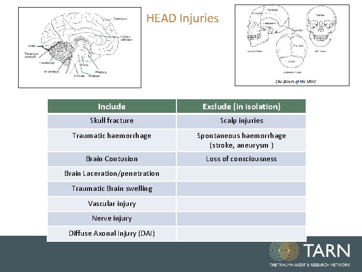 HEAD Injuries Include Exclude (in isolation) Skull fracture Scalp injuries Traumatic haemorrhage Spontaneous haemorrhage HEAD Injuries Include Exclude (in isolation) Skull fracture Scalp injuries Traumatic haemorrhage Spontaneous haemorrhage