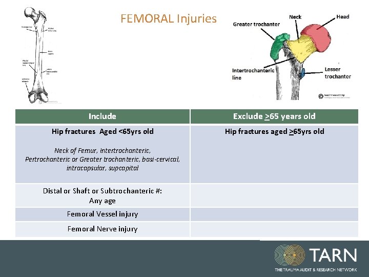 FEMORAL Injuries Include Exclude >65 years old Hip fractures Aged <65 yrs old Hip FEMORAL Injuries Include Exclude >65 years old Hip fractures Aged <65 yrs old Hip