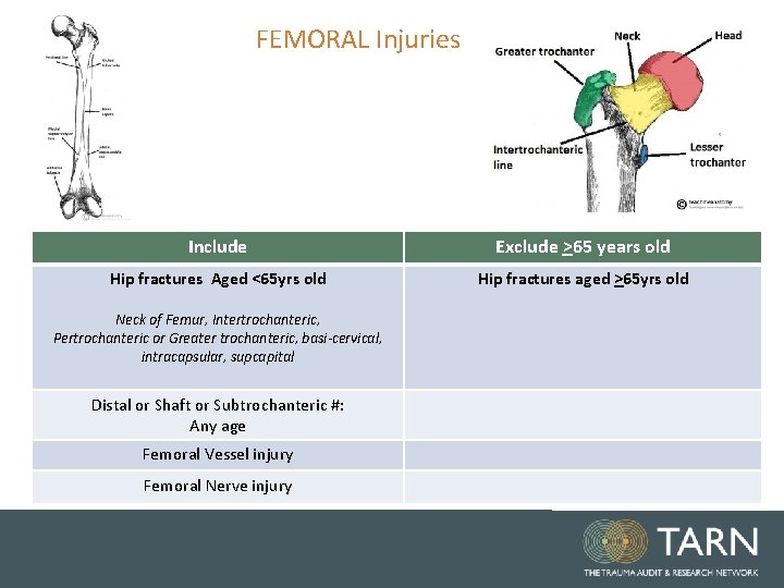 FEMORAL Injuries Include Exclude >65 years old Hip fractures Aged <65 yrs old Hip