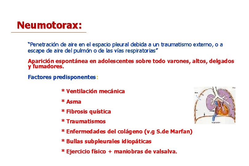Neumotorax: “Penetración de aire en el espacio pleural debida a un traumatismo externo, o