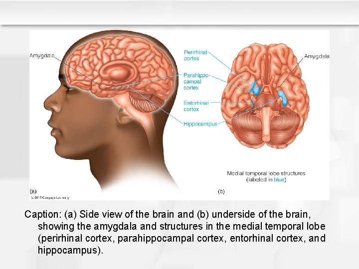 Caption: (a) Side view of the brain and (b) underside of the brain, showing