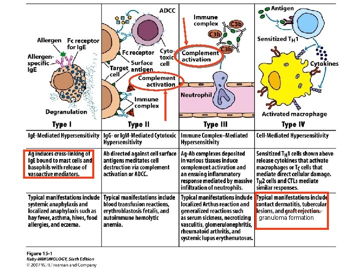 granuloma formation 