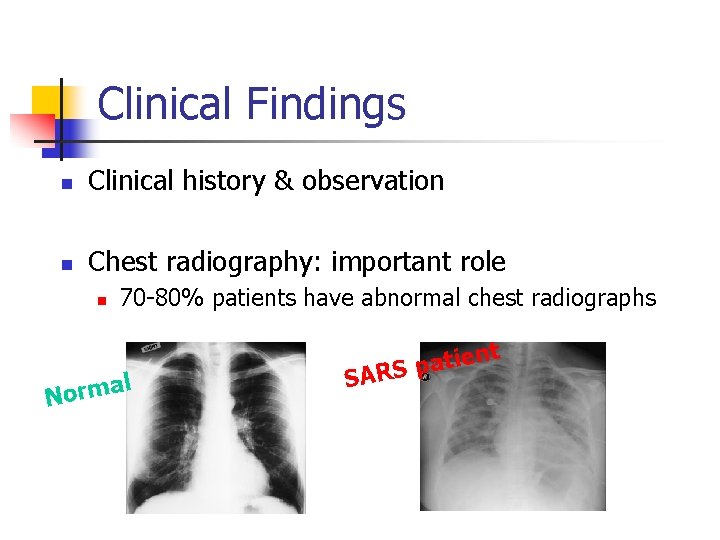 Clinical Findings n Clinical history & observation n Chest radiography: important role n 70