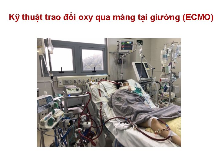 Kỹ thuật trao đổi oxy qua màng tại giường (ECMO) Kỹ thuật trao đổi oxy qua màng tại giường (ECMO)